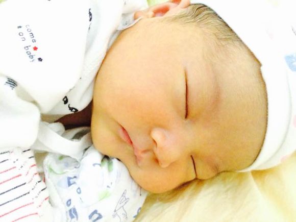 黃疸會(huì)影響智力嗎 三大疾病引起病理性黃疸