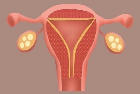 子宮內(nèi)膜薄總懷不上？