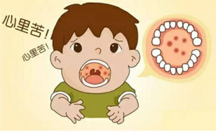 夏季高發(fā)的這種病不是口腔潰瘍！